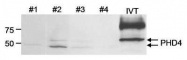 NB100-295 - P4HTM / PH4