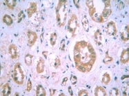 NB100-123 - HIF1A / HIF1 alpha