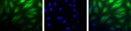 NB100-122 - HIF2A / HIF2 alpha