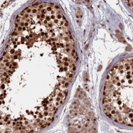 NBP1-89977 - HIF3A / HIF3 alpha