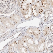 NBP1-84950 - HIPK3 / FIST / ANPK
