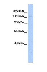 NBP1-54642 - HISPPD1