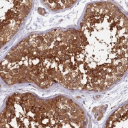NBP1-89693 - HISPPD2A / IP6 kinase