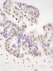 NBP1-18912 - HIV Tat-specific factor 1 / HTATSF1
