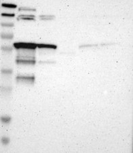 NBP1-91991 - AGFG1 / HRB