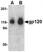 NBP1-76371 - HIV-1