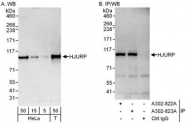 NBP1-47287 - HJURP