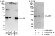 NBP1-47288 - HJURP