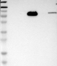 NBP1-85025 - HJURP