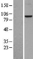 NBL1-11577 - HJURP Lysate
