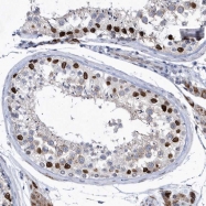 NBP1-86826 - HKR1