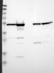 NBP1-91992 - HKR2 / ZNF50