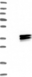 NBP1-85325 - HLA class II DM alpha / HLA-DMA