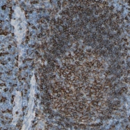 NBP1-89688 - HLA class II DP beta 1 / HLA-DPB1