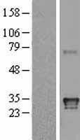 NBL1-11584 - HLA DQA1 Lysate