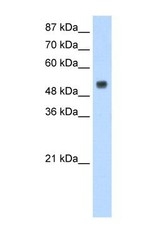NBP1-57247 - RBM45