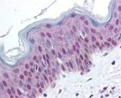 NBP1-78102 - HDAC1