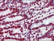 NBP1-50394 - HMGA1 / HMGIY