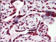 NBP1-50394 - HMGA1 / HMGIY