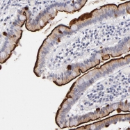 NBP1-87674 - HMGA1 / HMGIY