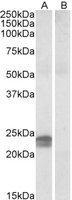 NBP1-36744 - HMGA1 / HMGIY