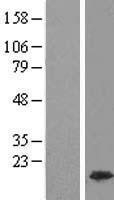 NBL1-11612 - HMGA1 Lysate