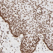 NBP1-81731 - HMGB2 / HMG2