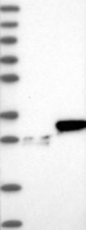 NBP1-81731 - HMGB2 / HMG2