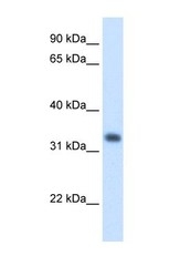NBP1-58026 - HMG-CoA lyase / HMGCL