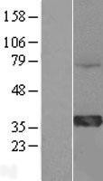 NBL1-11617 - HMGCL Lysate