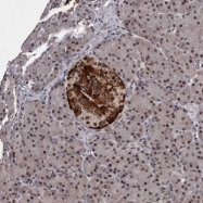 NBP1-88768 - HMGCLL1