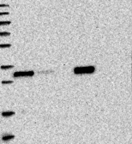 NBP1-88768 - HMGCLL1