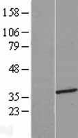 NBL1-11618 - HMGCLL1 Lysate