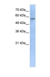 NBP1-54623 - HMG-CoA synthase / HMGCS
