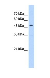 NBP1-54869 - mHMG-CoA synthase / HMGCS2
