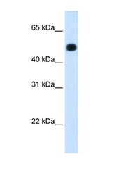 NBP1-54995 - mHMG-CoA synthase / HMGCS2