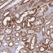 NBP1-91997 - HMX2