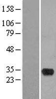 NBL1-11627 - HMX2 Lysate