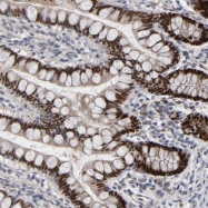 NBP1-89679 - HNF4 alpha / TCF14