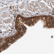 NBP1-89495 - HNMT / HMT