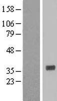 NBL1-11633 - HNMT Lysate