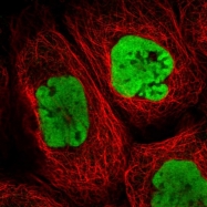 NBP1-83240 - hnRNP-A0 / HNRPA0
