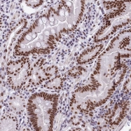 NBP1-83240 - hnRNP-A0 / HNRPA0
