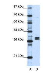 NBP1-57156 - hnRPD-like protein / HNRPDL