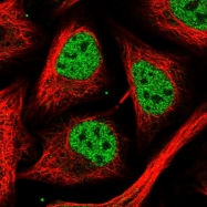 NBP1-90330 - hnRNP-H3 / HNRNPH3