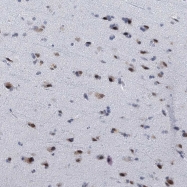 NBP1-90330 - hnRNP-H3 / HNRNPH3
