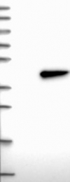 NBP1-82724 - HORMAD2