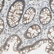NBP1-81722 - HOXA1 / HOX1F
