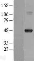 NBL1-11664 - HOXA10 Lysate