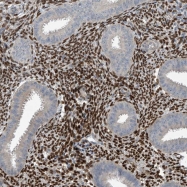NBP1-83233 - HOXA11 / HOX1I